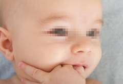 Baby Vitiligo Natural Therapy