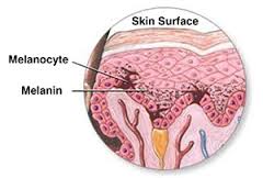 The Two Methods Used to Treat Vitiligo