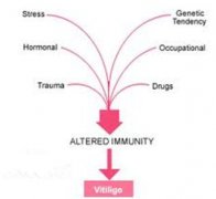 What Is The Essence of Vitiligo