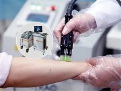 [Vitiligo Phototherapy Guide] The Higher th